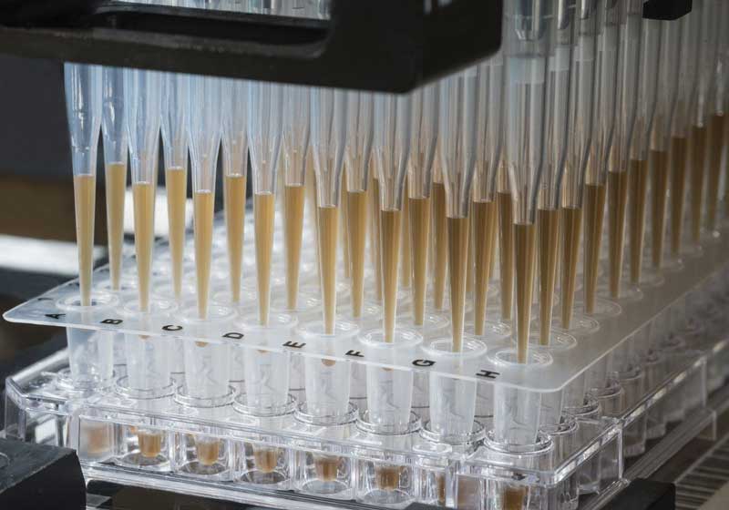 Avaliação com o teste CancerSEEK. Foto: FRED DUBS