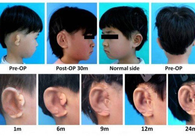 Foto: Reprodução EBioMedicine|