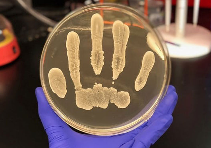 Staphylococcus epidermidis Foto: UC San Diego Health