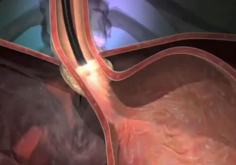 Foto: reprodução / Youtube