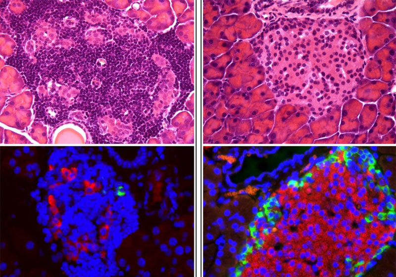 A célula do lado direito