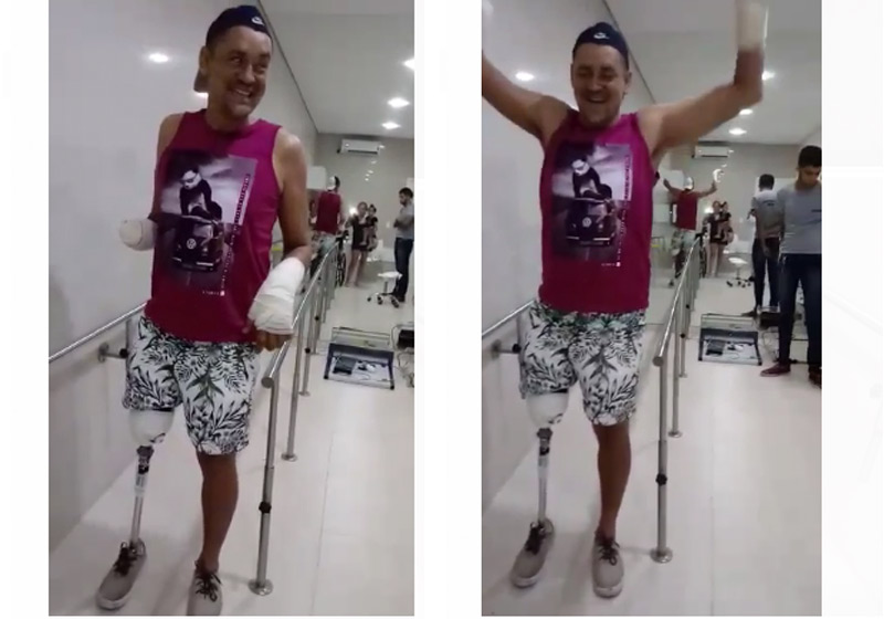 Fotos: arquivo pessoal / divulgação autorizada|Pablo Diego com a prótese - Foto: arquivo pessoal / divulgação autorizada