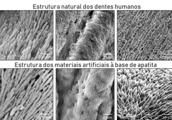 Comparativo entre a estrutura do material artificial (embaixo) e do esmalte dos dentes (em cima). Imagemm: Sherif Elsharkawy