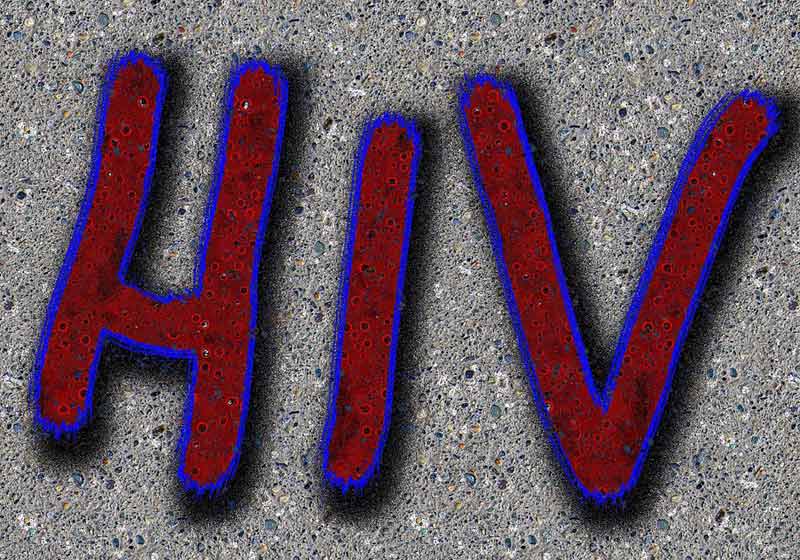 Célula infectada pelo HIV - Foto: National Institute of Allergy and Infectious Diseases