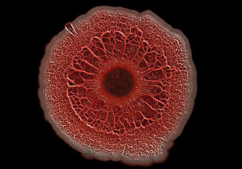 Uma colônia de milhões da bactéria Pseudomonas aeruginosa. Foto: NIH