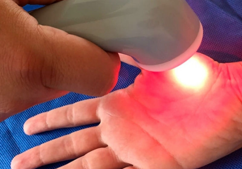 Laser capaz de diminuir as dores - Foto: IFSC