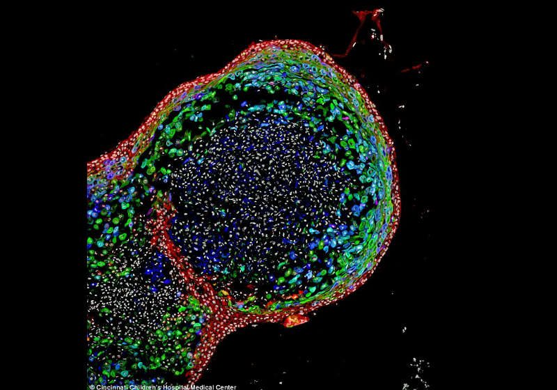 A imagem apresenta as camadas de tecido de um organoide de esôfago de dois meses Foto: Hospital Infantil de Cincinnati.