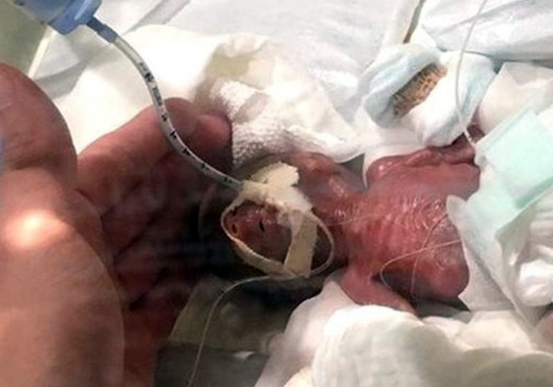 Saybie tendo alta - Foto: reprodução / The Washington Post|