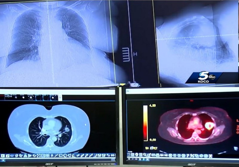 Foto: reprodução Koko 5 - ABC Television|Foto: reprodução Koko 5 -abc||