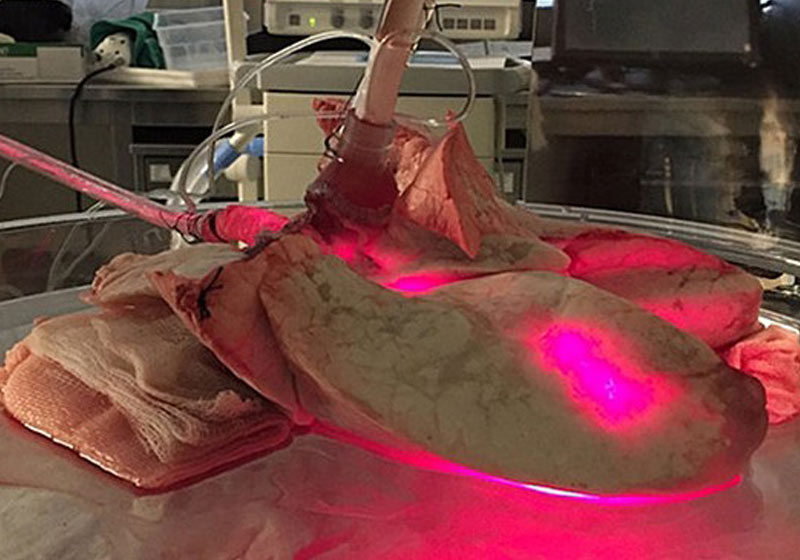 Descontaminação de órgãos: Foto: Cristina Kurachi