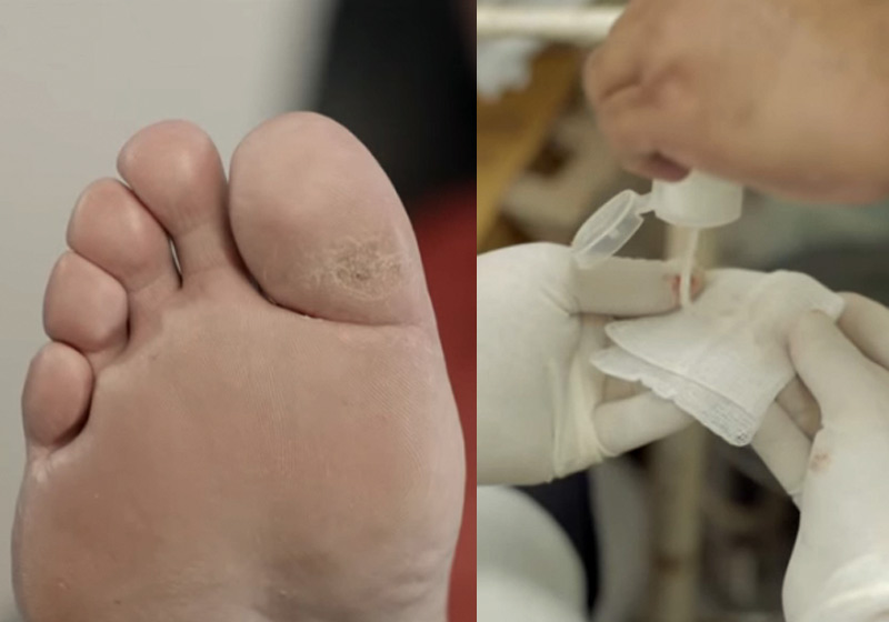 Pé curado de Mauro Paulino - Fotos: reprodução / Youtube|||