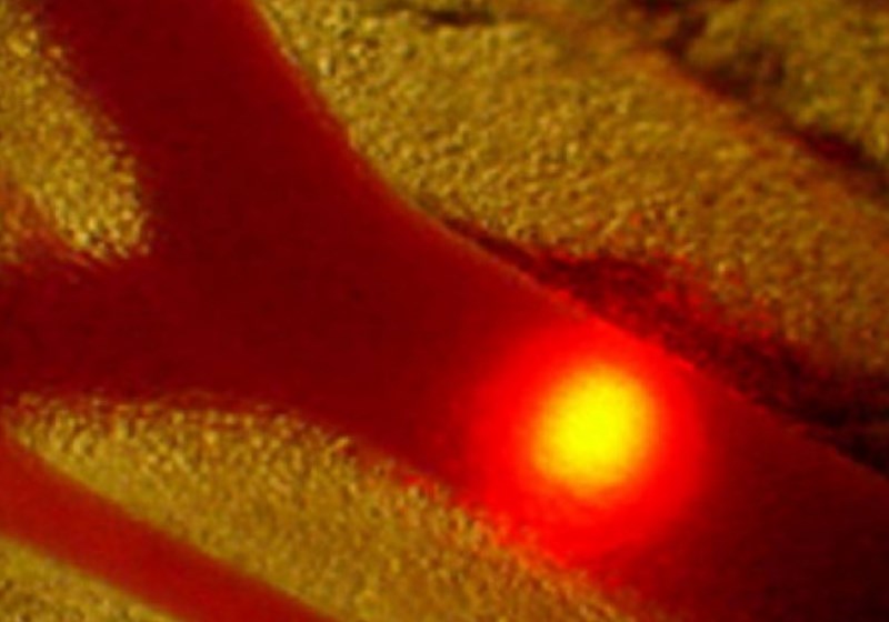 O dispossitivo a laser nos vasos sanguíneos (aqui