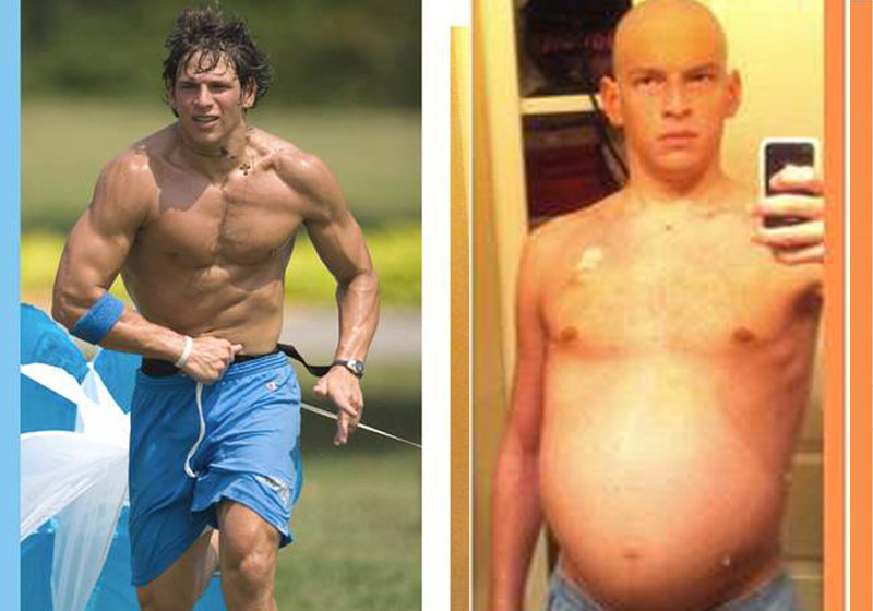 David Fajgenbaum depois e antes - Fotos: reprodução / Facebook|