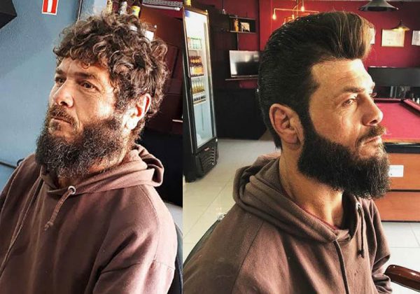 Peterson antes e depois - Fotos: Alexandre Brehmer