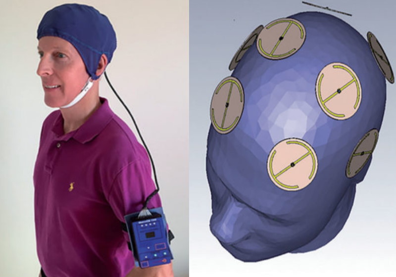 Foto: Journal of Alzheimer’s Disease