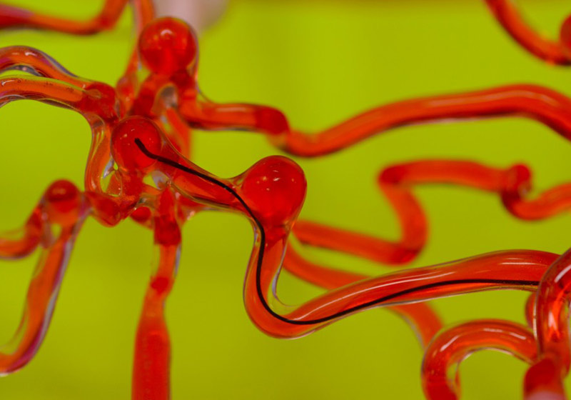 Robô dirige fio por veias e artérias - Foto: reprodução / MIT