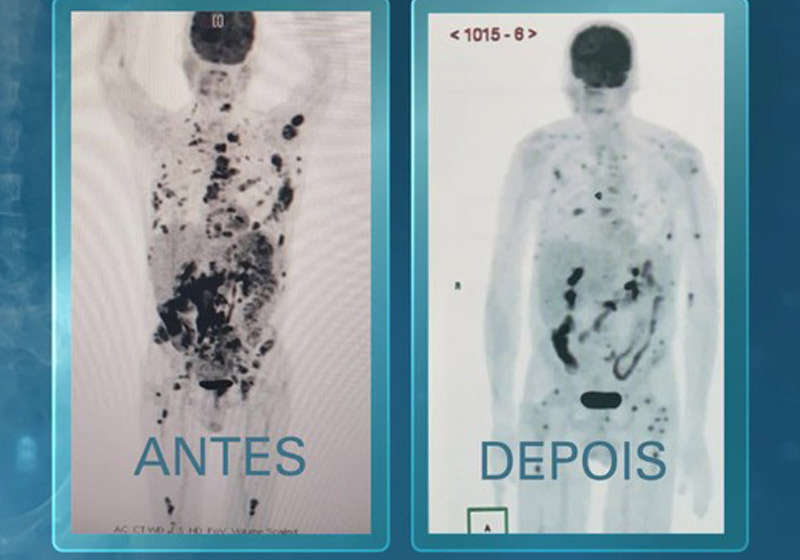 Manchas de Vamberto desaparecendo - Foto: Reprodução/Fantástico