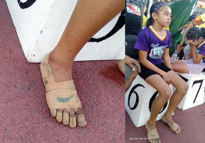 menina-nike-close Rhea Bullos com ataduras desenhadas - Foto: reprodução / redes sociais