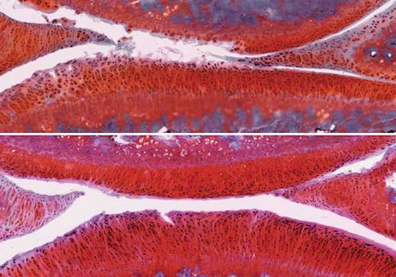 Artrite grau 2 acima e Artrite tratada em rato abaixo - Fotos: Instituto Salk|