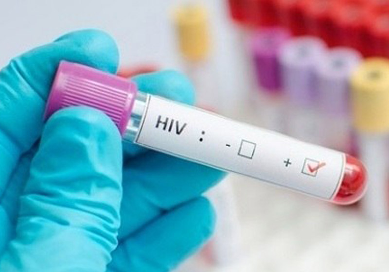 Como tirar HIV do esconderijo - Foto: Thinkstock