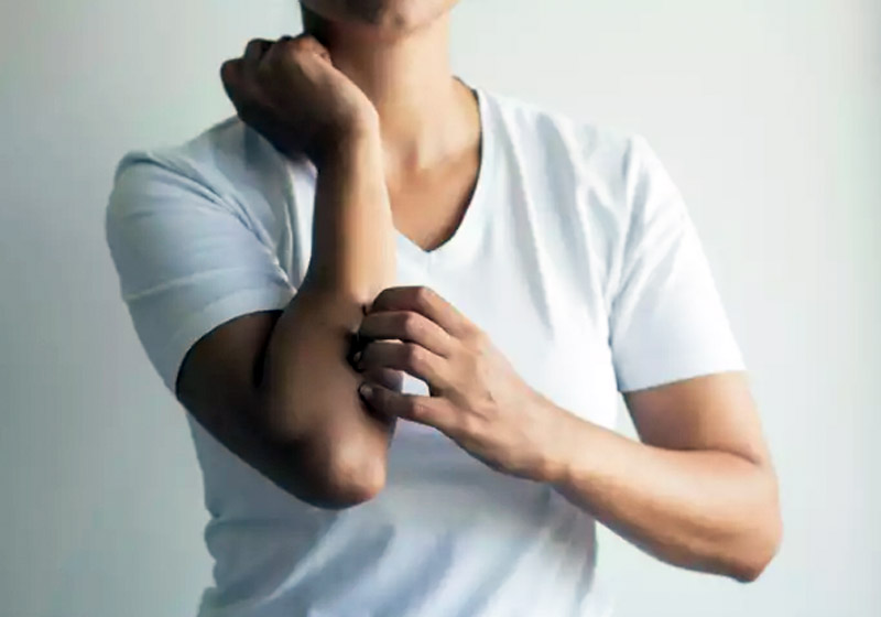 Lúpus pode provocar vermelhidão e coceira na pele - Getty Images/iStockphoto