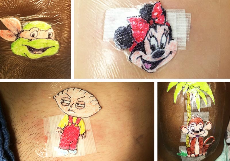 Curativos do do Dr. Robert - Foto: reprodução / Hospital Infantil Akron|Curativos personalizados do Dr. Robert - Fotos: Hospital Infantil Akron||Um dos pacientes do Dr. Robert - Foto: reprodução / Hospital Infantil Akron|