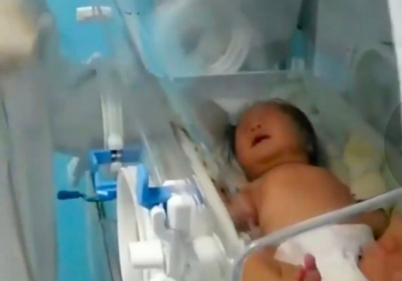 Xiao Xiao enquanto era tratada - Foto: AsiaWire / Wuhan Children's Hospital|