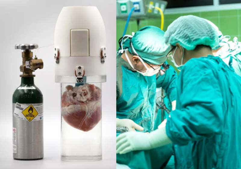 Equipamento mantém coração vivo por 24 h - Fotos: reprodução / DailyMail|Foto: reprodução|