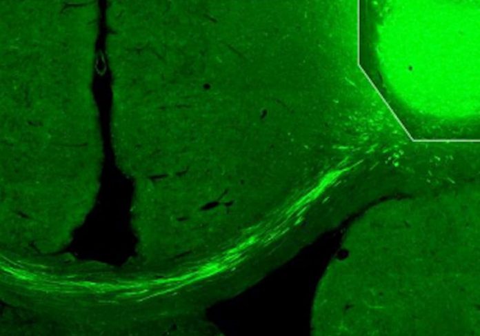 AVC-transplante-celulas-close Células transplantadas enviam fibras nervosas para o lado oposto do córtex cerebral de ratos com AVC - Foto: Universidade de Lund