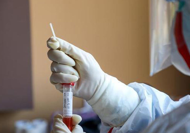 Tratamento feito com sangue - Foto: Yuan Zheng / EFE-EPA