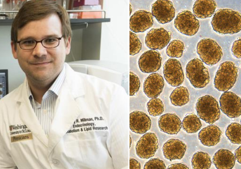 Foto: reprodução LABORATÓRIO MILLMAN