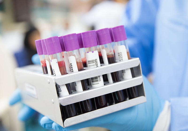 Testes de sangue - Foto: Ahmad Ardity / Pixabay