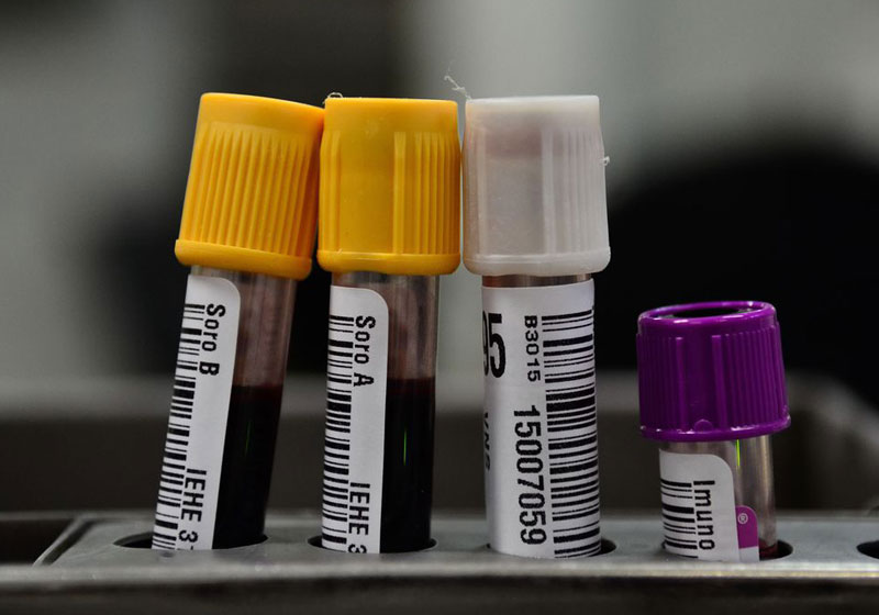 Exames de sangue - Foto: Fernando Frazão /Agência Brasil