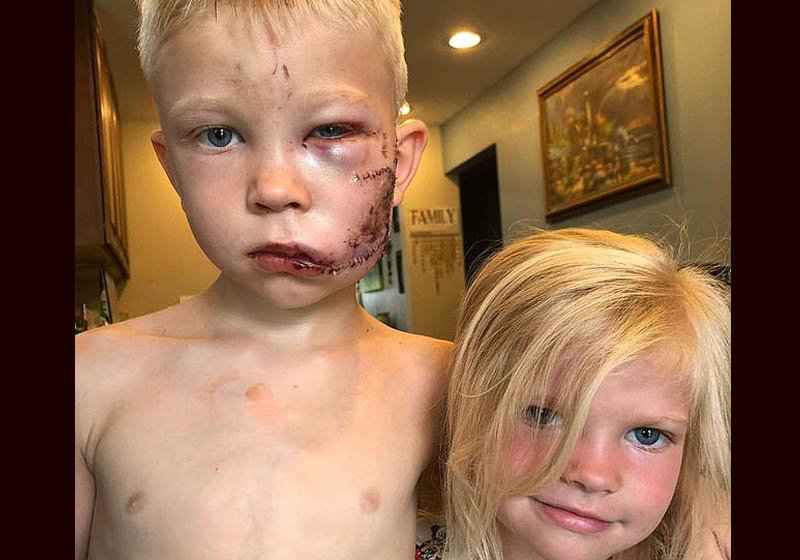 Briger e a irmã que salvou - Foto: @nicolenoelwalker