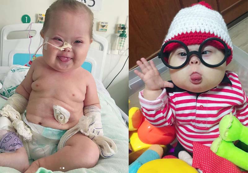 Super Chico venceu Covid - Fotos: reprodução / Instagram