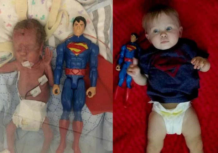 Logan quando nasceu e com 1 ano - Fotos: SWNS