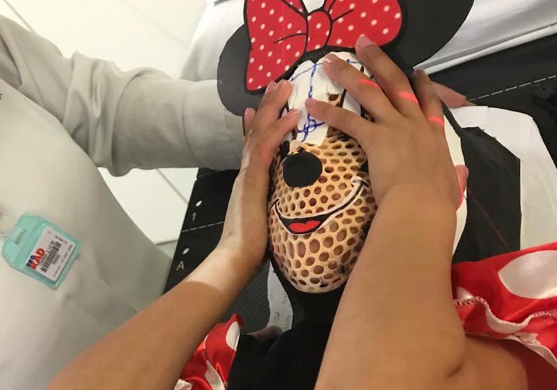 Máscara usada por Paloma - Foto: Hospital Baleia /divulgação