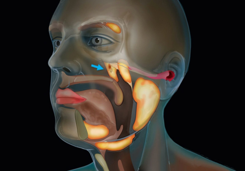 Novas glândulas - Foto: reprodução / NKI