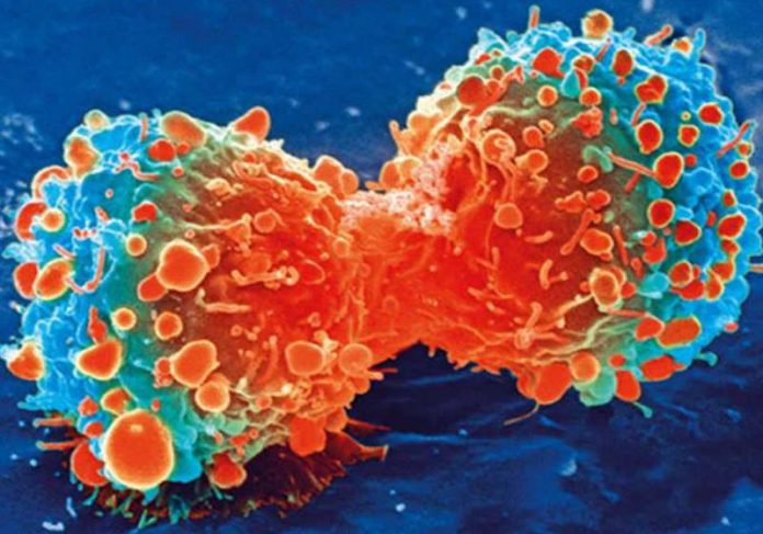 cancer_edicao Célula cancerosa durante a divisão celular Foto: National Institutes of Health