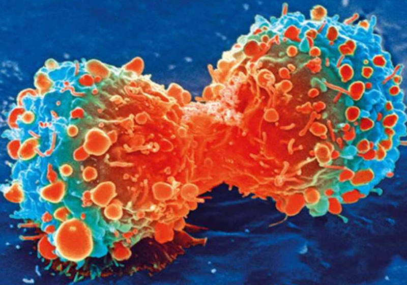 Célula cancerosa durante a divisão celular Foto: National Institutes of Health