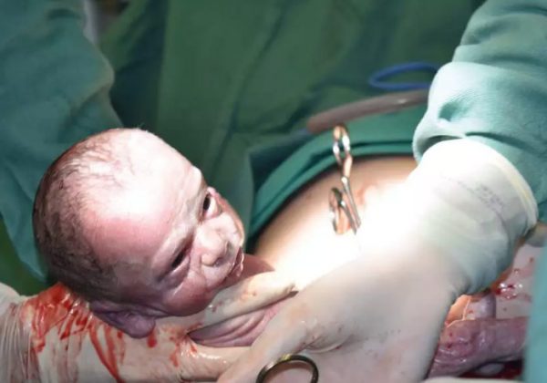 Outro filho de Taíza - Foto: Hospital Santo Antônio/Divulgação