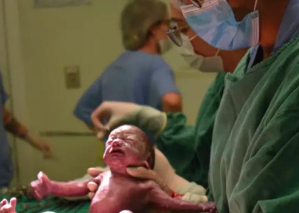 Um dos filhos de Taíza - Foto: Hospital Santo Antônio/Divulgação