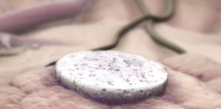 Vacina contra câncer criada em Harvard é eficaz em 100% dos testes Vacina implantável de Harvard contra câncer - Foto: reprodução / Harvard