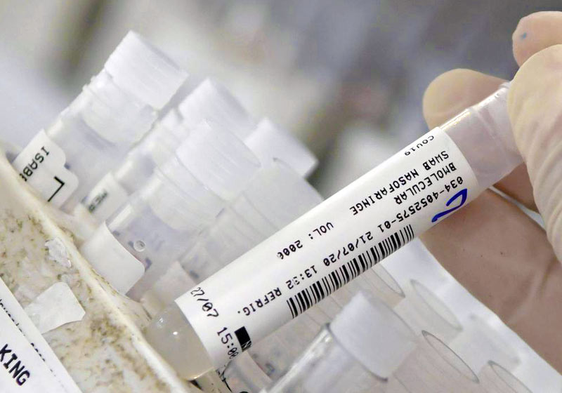 Vacina contra Covid-19 - Foto: Washington Alves/ Reuters