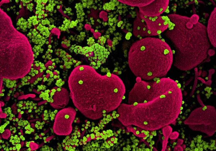 quimioterapico_covid Foto: Instituto Nacional de Alergia e Doenças Infecciosas