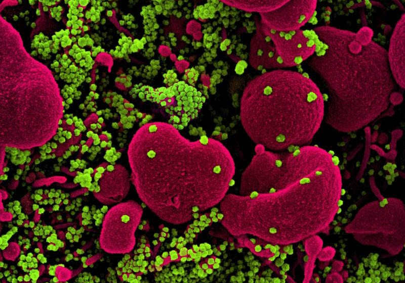 Foto: Instituto Nacional de Alergia e Doenças Infecciosas