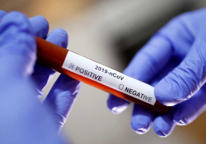 Cientistas testaram anticorpo que previne e trata a covid-19 em camundongos e os resultados foram positivos. - Foto: reprodução Reuters