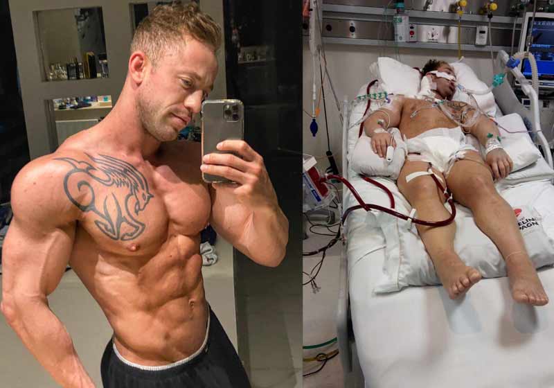 O milagre do fisiculturista Kaíque Barbante - Fotos: arquivo pessol