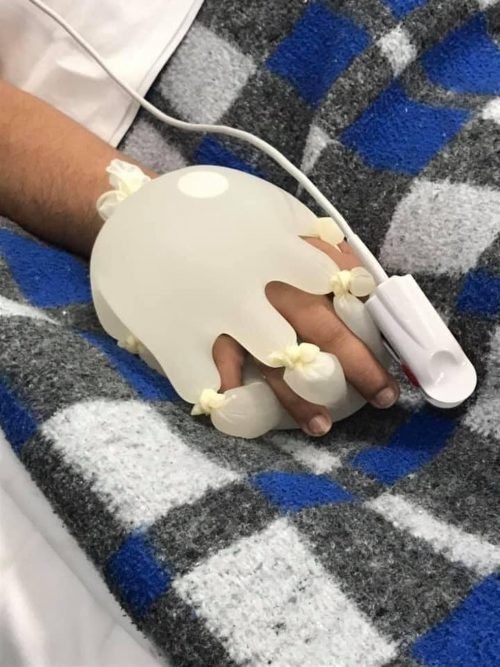 Técnica da mãozinha criada pela enfermeira Lidiane - Foto: reprodução / redes sociais