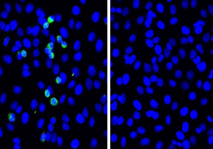 cov_replicacao Foto: Taisho Yamada, et al. Nature Immunology